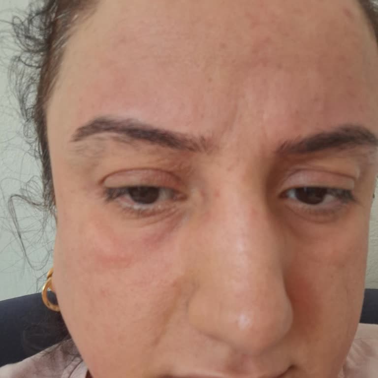 Bioderma Atoderm Kreminin Sahte Olma Şüphesi Ve İade Sorunu