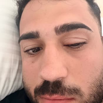 Havuz Suyunda Enfeksiyon: Otel Sağlık İhmali Ve Ücret Talepleri