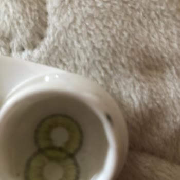 Katalog Rengiyle Uyuşmayan Sahte Lens Ve Umursamaz Mağaza Servisi