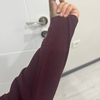 Fiore Of Dress’in Tek Kullanımda Tüylenme Ve Deformasyonlu Elbisesi İçin Tam İade Talebi