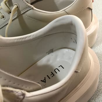 Lufian Sneaker’da Deri Soyulması Ve Hızlı İade Talebi