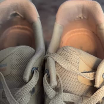 Skechers Ayakkabısında Altı Ay İçinde Ortak Yırtılma Ve Firmadan Reddetme