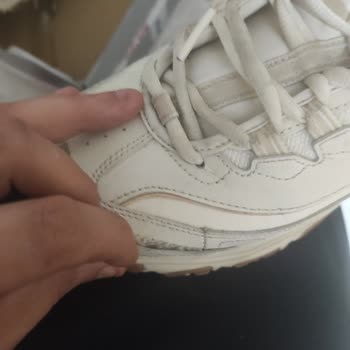 Garanti Reddi Skechers Ayakkabısında Üretim Kusuru İddiası
