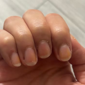 Pastel 425 Nude Serisi Ojesi Turuncu Lekeler Bıraktı
