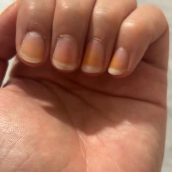 Pastel 425 Nude Serisi Ojesi Turuncu Lekeler Bıraktı