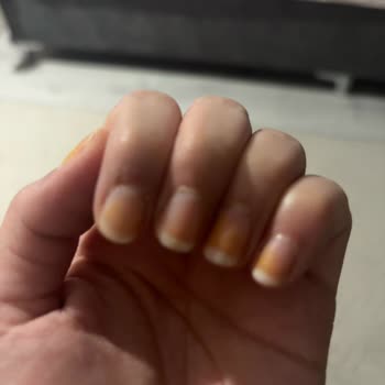 Pastel 425 Nude Serisi Ojesi Turuncu Lekeler Bıraktı
