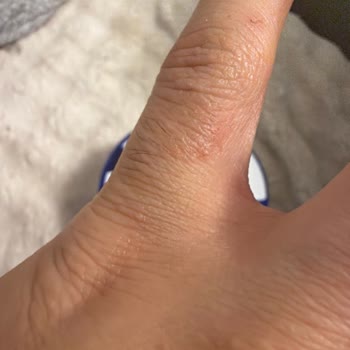 Yapışkan His Ve Egzama Yaratan Nemlendirici Krem