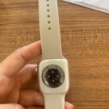 Garanti Reddine Ve Aşırı Ücret Talebine Karşı Apple Watch Hoparlör Arızası