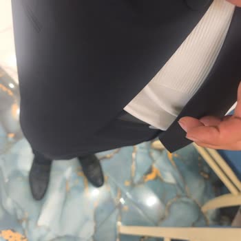 Damatlıkta Güvenlik Etiketi Unutulması Ve Düğme Kırılması Nedeniyle Mağduriyet