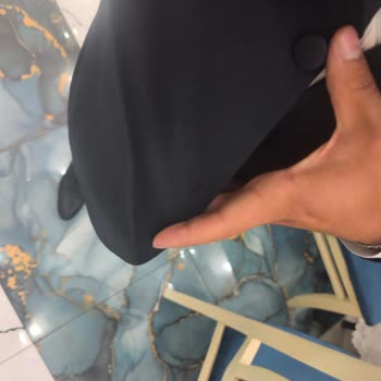 Damatlıkta Güvenlik Etiketi Unutulması Ve Düğme Kırılması Nedeniyle Mağduriyet
