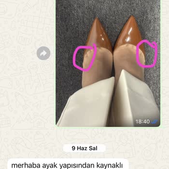 Üretim Hatası Ve Para İadesi Talebi: Ayakkabı Prensesi Şikayeti