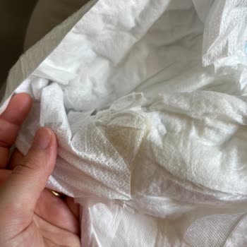 Molfix 6 Numaralı Bebek Bezinde Yapışkan Kalıntı Ve Leke Endişesi