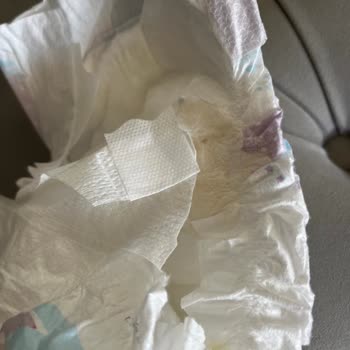 Molfix 6 Numaralı Bebek Bezinde Yapışkan Kalıntı Ve Leke Endişesi