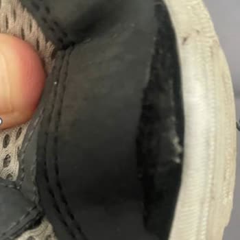 Skechers Çocuk Ayakkabısında 3 Ayda Taban Ayrılması: Hızlı İade Ve Değişim Talebi