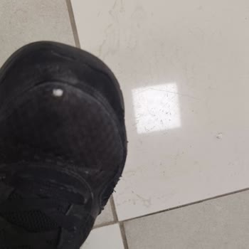 Skechers Ayakkabılarda Kalite Sorunu Ve Trendyol’un Kullanıcı Hatası İddiası