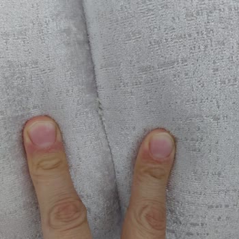 Kusurlu Koltuk Takımı Ve Verilmeyen Hediye İçin Çözüm Talebi