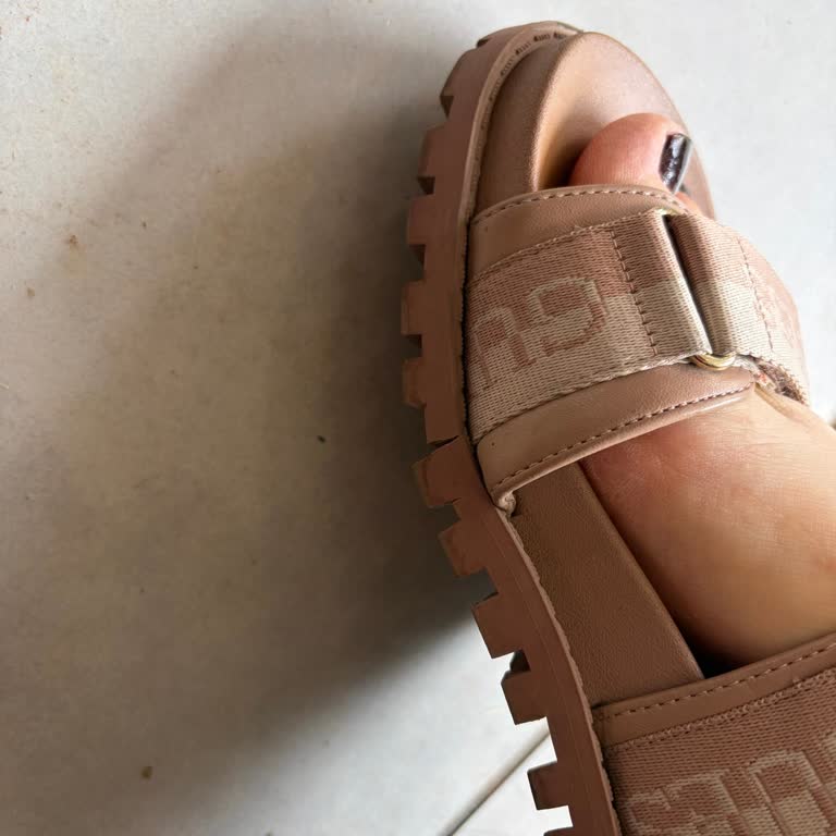 Guess Sandaletinde Alt Taban Yırtılması Ve Ayrılma Sorunu