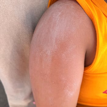 Bioderma Photoderm Spot SPF 50 Güneş Kremi Ciltte Plastik Tabaka Oluşturuyor