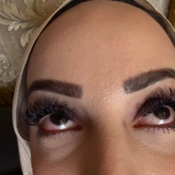 Hijyen İhlali Ve Göz Enfeksiyonu Sonrası Saygısız İşletme Tutumu
