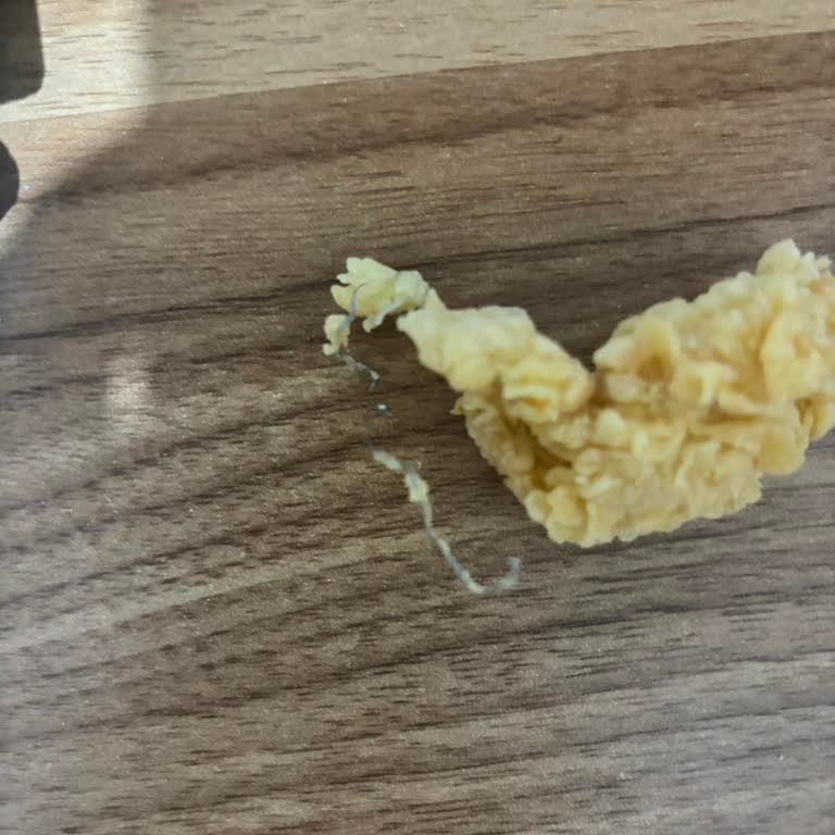Popeyes Nugget’inde Metal Parça Bulunması Ve Gıda Güvenliği Endişesi