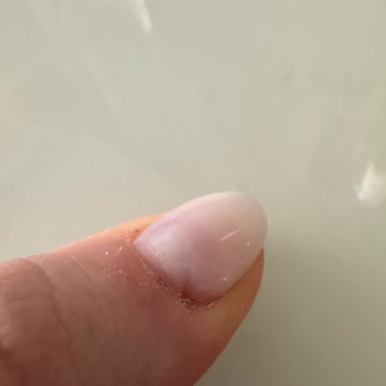 Kalitesiz Protez Tırnak Ve Verilen Sözün Tutulmaması