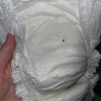 Yabancı Leke Görülen Bebek Bezinde Hijyen Endişesi Ve Cevapsız Şikayet