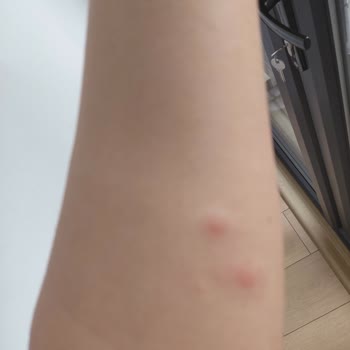 Belediye Arsası Bakımsız, Acil İlaçlama Ve Temizlik Gerekiyor
