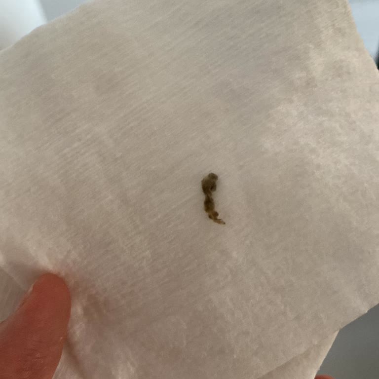 Baby Me Temizleme Pamuklarında Yabancı Parça Bulunması