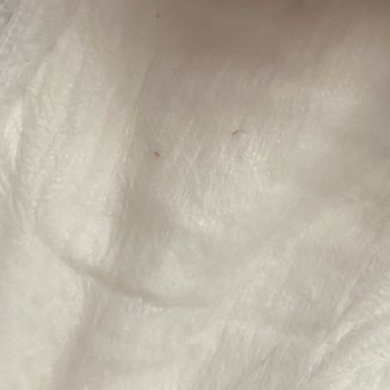 Baby Turco Doğadan Bezlerde Sert Parçalar Ve Bebeğin Cilt Tahrişi