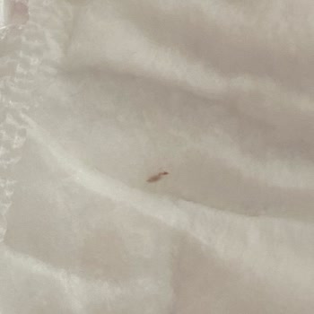 Baby Turco Doğadan Bezlerde Sert Parçalar Ve Bebeğin Cilt Tahrişi