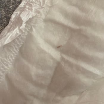 Baby Turco Doğadan Bezlerde Sert Parçalar Ve Bebeğin Cilt Tahrişi