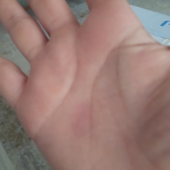 Tekrar Eden Güvenlik Sorunu Nedeniyle Ürün İadesi Talebi
