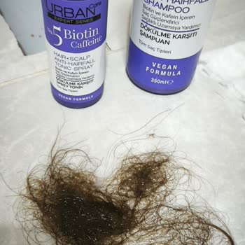 Biotin Kafein Şampuanı Nedeniyle Aşırı Saç Dökülmesi Ve İade İsteği