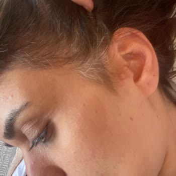 L’Oreal Saç Boyası Beyazları Kapatmadı Ve Ücret İadesi Talebi