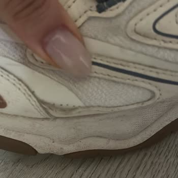 Skechers Ayakkabısındaki Dikiş Açılması Ve İade Talebinin Reddedilmesi