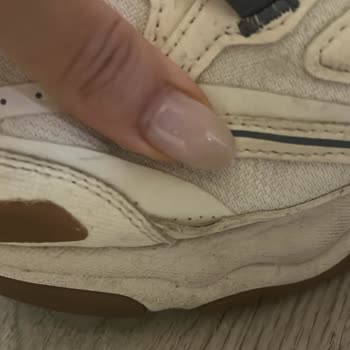 Skechers Ayakkabısındaki Dikiş Açılması Ve İade Talebinin Reddedilmesi