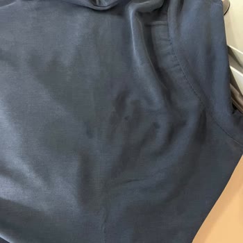 Leke İçeren Takım Cevapsız Değişim Ve İade Talebi