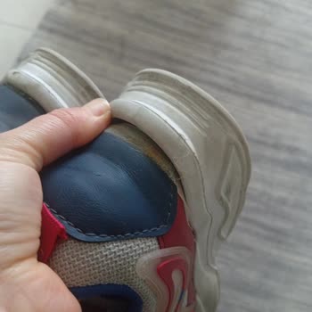 Ayakkabının Tek Hafta Kullanımda Ayrılması Ve Mağaza Tarafından Üretim Hatası Olarak Reddedilmesi