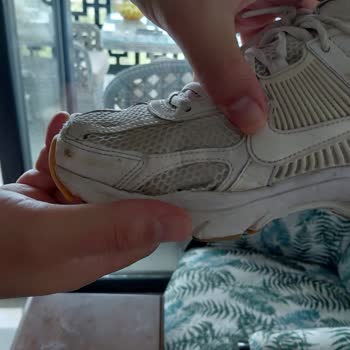 Nike Zoom Vomero Sneaker Kısa Sürede Yanlardan Sökülme Ve Mağaza Reddetmesi