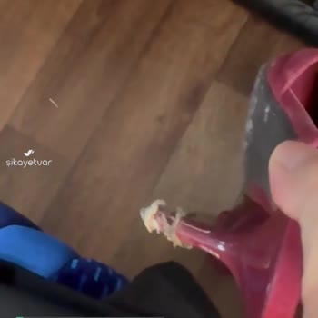 Zara Normal Kullanım Koşullarında Topuk Kısmının Alt Yüzeyinde Soyulma