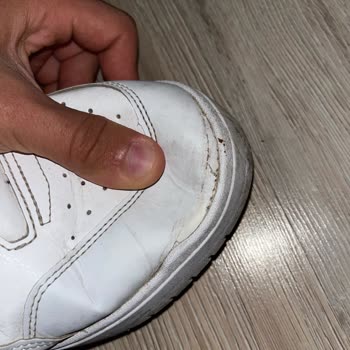 Aynı Ayakkabıda Açılma Sorunu Ve Garanti Reddi