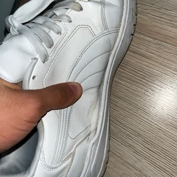 Aynı Ayakkabıda Açılma Sorunu Ve Garanti Reddi