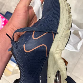 Skechers Ayakkabısının Kısa Sürede Deforme Olması Ve Cevapsız Servis