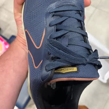 Skechers Ayakkabısının Kısa Sürede Deforme Olması Ve Cevapsız Servis