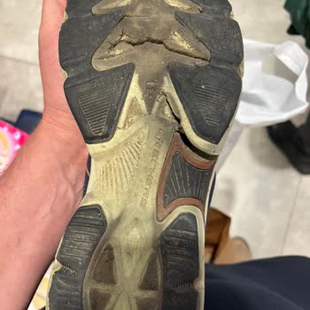 Skechers Ayakkabısının Kısa Sürede Deforme Olması Ve Cevapsız Servis