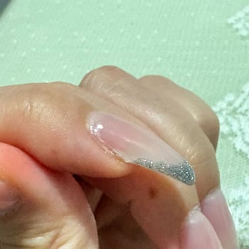 Enfeksiyonlu Tırnak Uygulaması Ve İlgisiz Yaklaşım