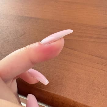 Enfeksiyonlu Tırnak Uygulaması Ve İlgisiz Yaklaşım