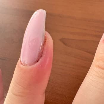 Enfeksiyonlu Tırnak Uygulaması Ve İlgisiz Yaklaşım