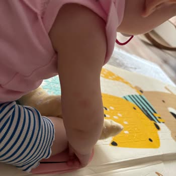 Mustela Losyonunda Bebekte Şiddetli Kızarıklık Ve İade Talebi