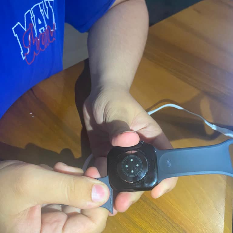 Kusurlu Apple Watch’ta Kordon Sorunu Ve Mağazanın İade Reddi